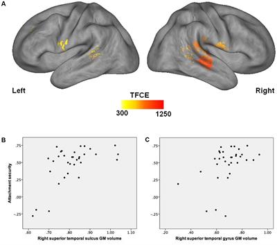 Attachment Security in Infancy: A Preliminary Study of Prospective Links to Brain Morphometry in Late Childhood